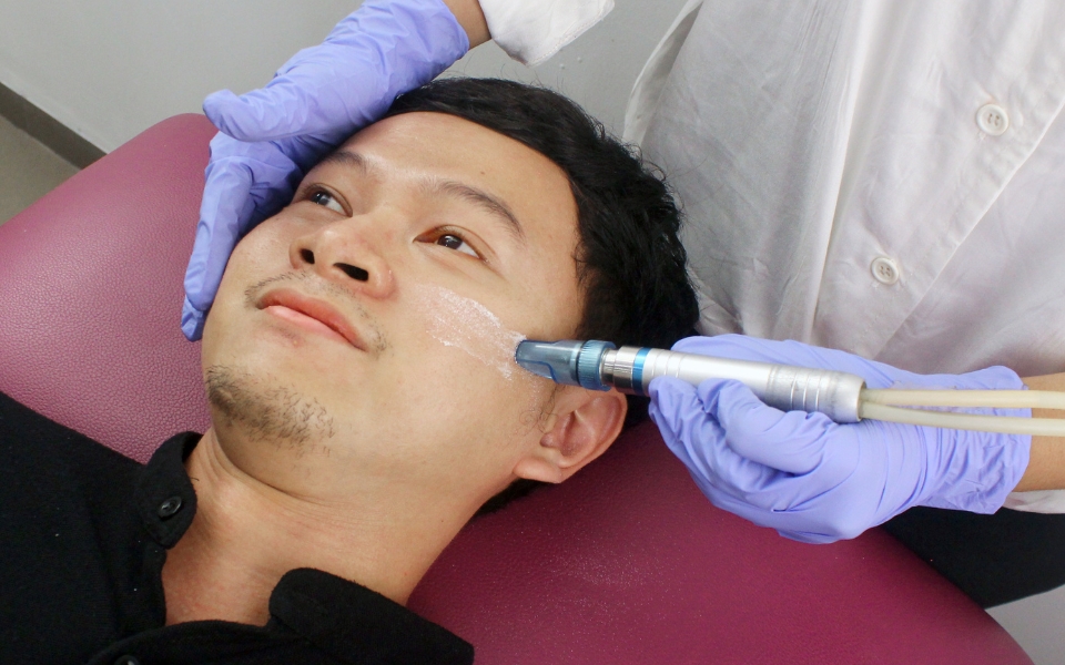 perawatan kulit wajah microdermabrasion crystal